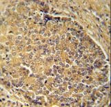 IGSF1 Antibody (aa1270-1297)