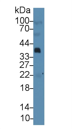 PTHLH / PTHRP Antibody (aa37-177)