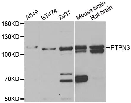PTPN3 Antibody
