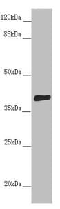 DYNC2LI1 / D2LIC Antibody
