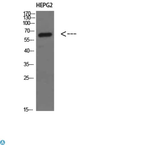 Polyclonal Rabbit anti-Human MIA2 Antibody (WB)