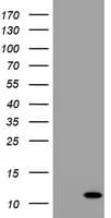 PathPlus™ B2M / Beta 2 Microglobulin Antibody (clone OTI1A9)