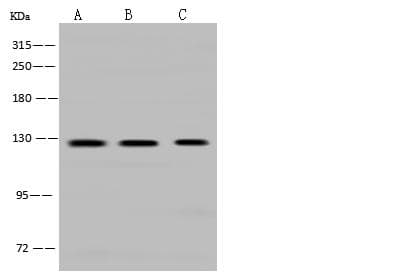 Polyclonal Rabbit anti-Human CDH1 / E Cadherin Antibody (WB)