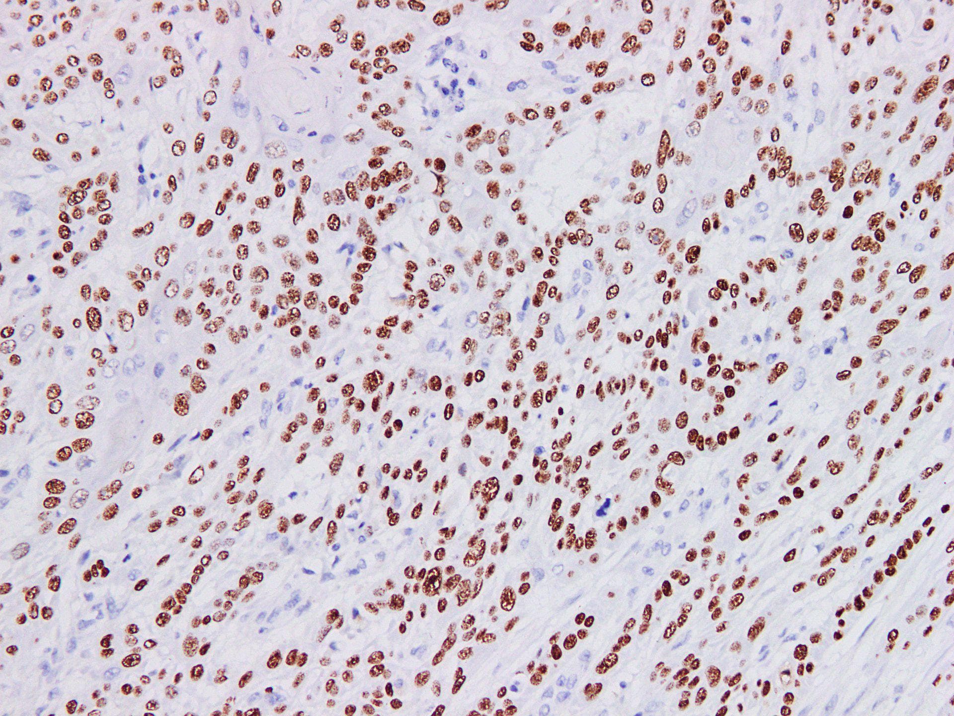 Monoclonal Mouse TP63 Isoform p40 / Delta-Np63 Antibody (IHC)