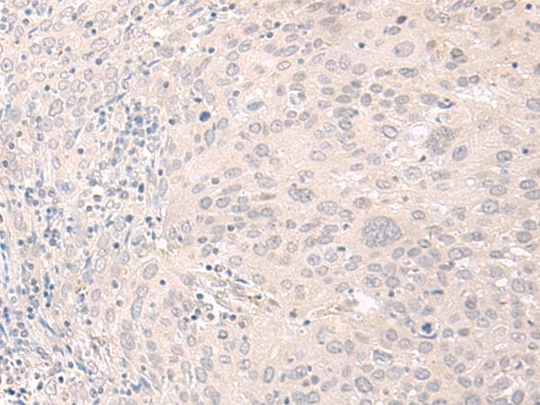 Polyclonal Rabbit anti-Human FOXRED2 Antibody (IHC)