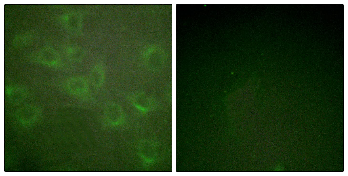 KCNA3 / Kv1.3 Antibody (phospho-Tyr135)