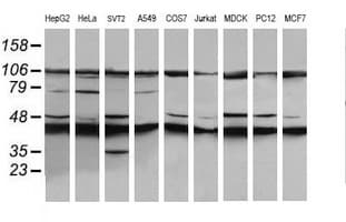MAP2K1 / MKK1 / MEK1 Antibody (clone OTI2D4, Carrier-free)