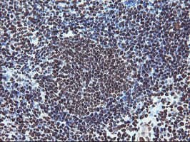 FMR1 / FMRP Antibody (aa36-279, clone OTI5B9)