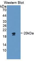 GYPA / CD235a / Glycophorin A Antibody (aa1-108)