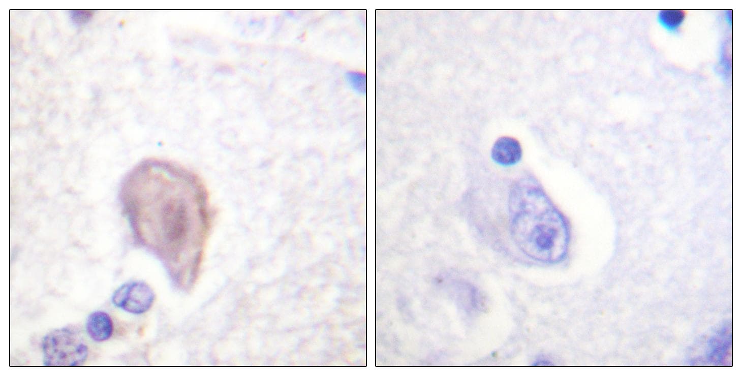 RAF1 / RAF Antibody (p43)