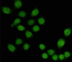 TBL1X / TBL1 Antibody
