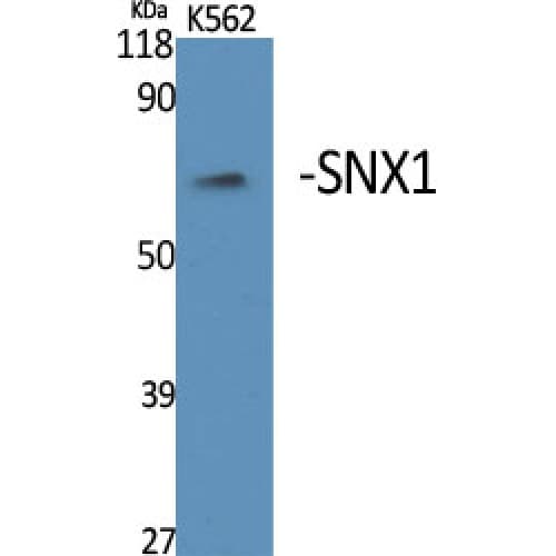 Polyclonal Rabbit anti-Human SNX1 Antibody (Internal, WB)
