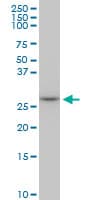 MAGE12 / MAGEA12 Antibody (clone 3A10)
