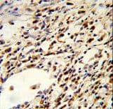 FLCN / Folliculin Antibody (aa325-354)