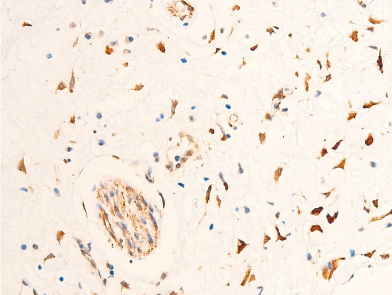 CHEK2 / CHK2 Antibody (phospho-Thr68)