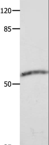 Polyclonal Rabbit anti-Human CAP2 Antibody (IHC, WB)