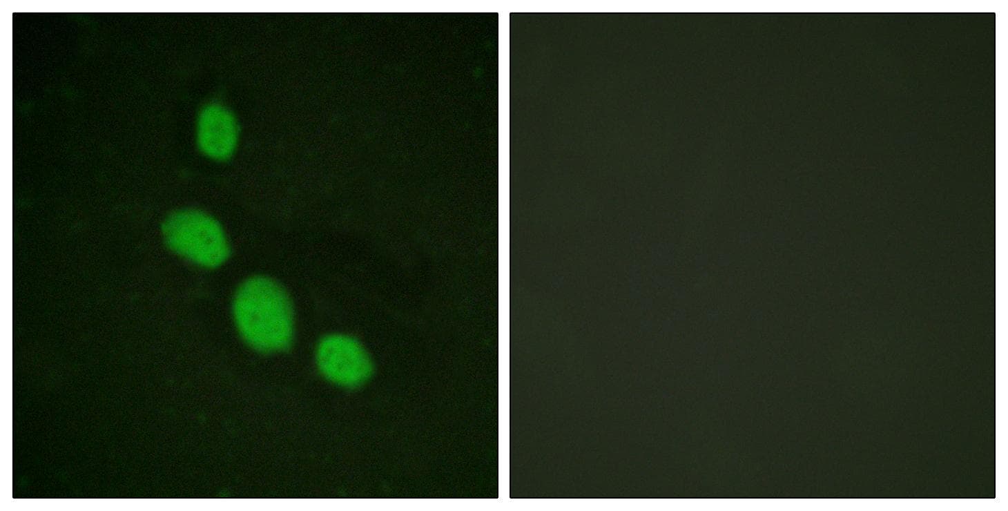 Polyclonal Rabbit anti-Human C/EBP Epsilon / CEBPE Antibody (p74, IHC, IF, WB)