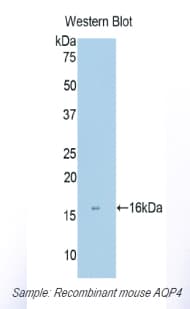 AQP4 / Aquaporin 4 Antibody (aa177-304)