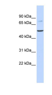 Polyclonal Rabbit anti-Human BAAT / BAT Antibody (N-Terminus, IHC, WB)