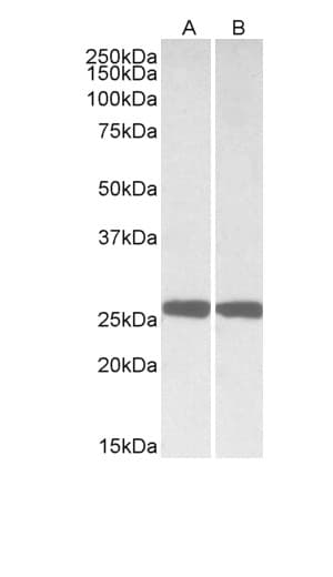 IHC-plus™ Polyclonal Goat anti-Human UCHL1 / PGP9.5 Antibody (aa58-68, IHC, WB)