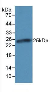 CRP / C-Reactive Protein Antibody (aa20-222)