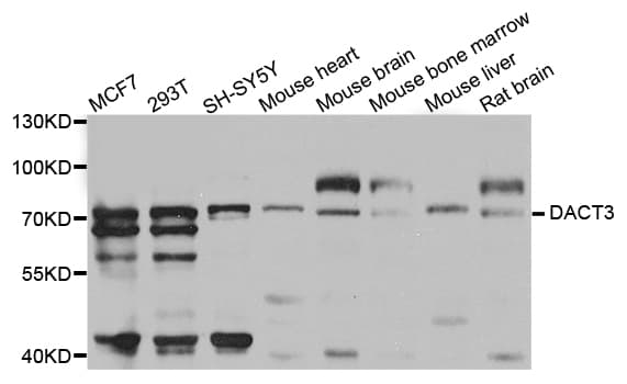 Polyclonal Rabbit anti-Human DACT3 Antibody (WB)