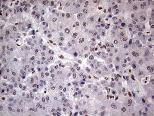 C14orf166 Antibody (clone OTI1E5)