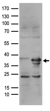 RFC2 / RFC40 Antibody