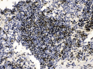 Polyclonal Rabbit anti-Mouse PML Antibody (IHC, WB)
