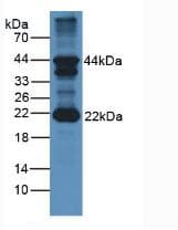 FSHB / FSH Beta Antibody (aa21-129, APC)