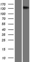 TMEM1 / TRAPPC10 Protein (Over-Expression Lysate Myc-DDK (Flag))