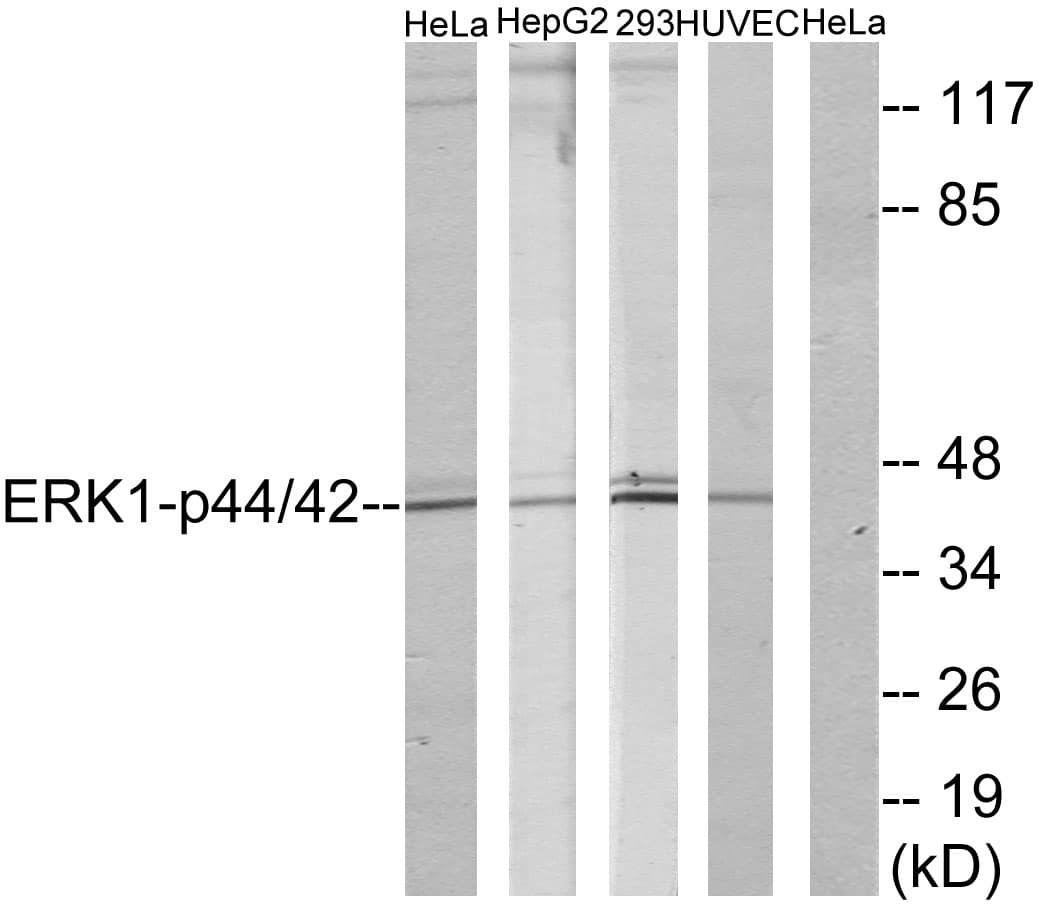 ERK1 + ERK2 Antibody (aa170-219)