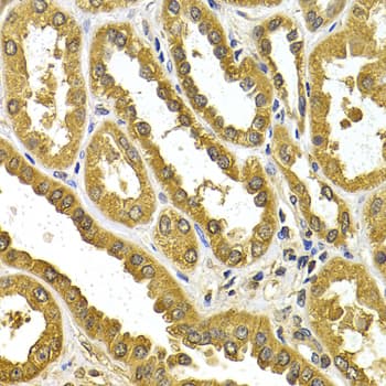 Polyclonal Rabbit anti-Human UGT1A4 Antibody (IHC, WB)