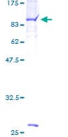 Human MTMR6 Protein (Recombinant GST)