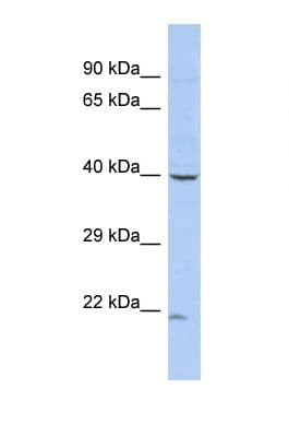 ZNF232 Antibody (aa51-100)
