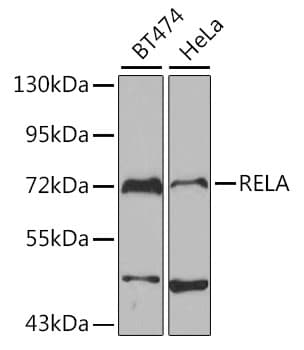RELA / NFKB p65 Antibody