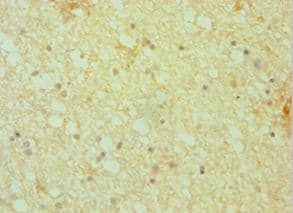 Polyclonal Rabbit anti-Human DCTN1 / Dynactin 1 Antibody (aa1084-1278, IHC, WB)