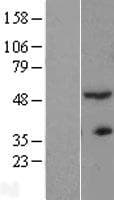 ACTR3B / ARP4 Protein (Over-Expression Lysate Myc-DDK (Flag))