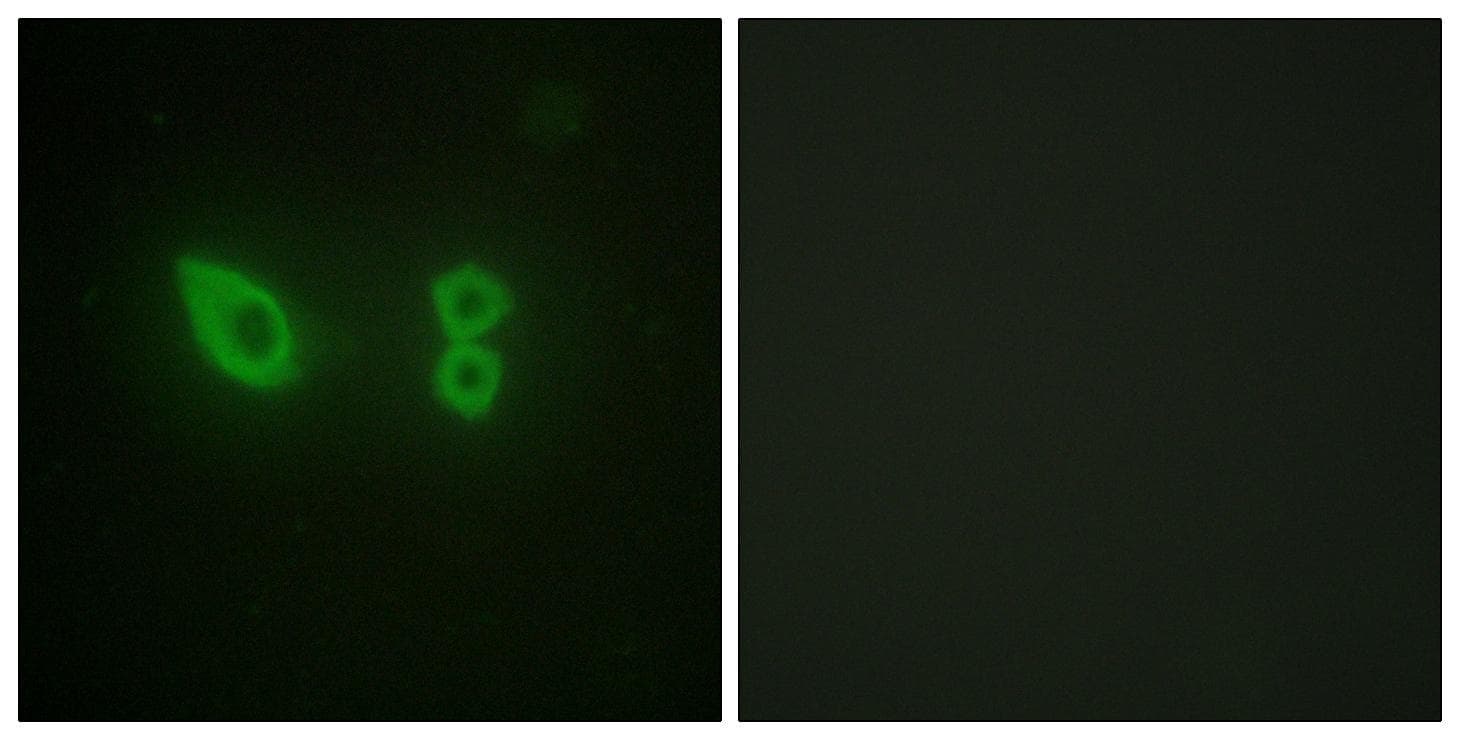 Actinin-Alpha 2+3 Antibody