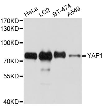 YAP / YAP1 Antibody