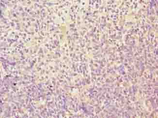 Polyclonal Rabbit anti-Human TMEM184C Antibody (IHC)