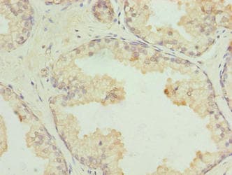 Polyclonal Rabbit anti-Human GPR21 Antibody (IHC)
