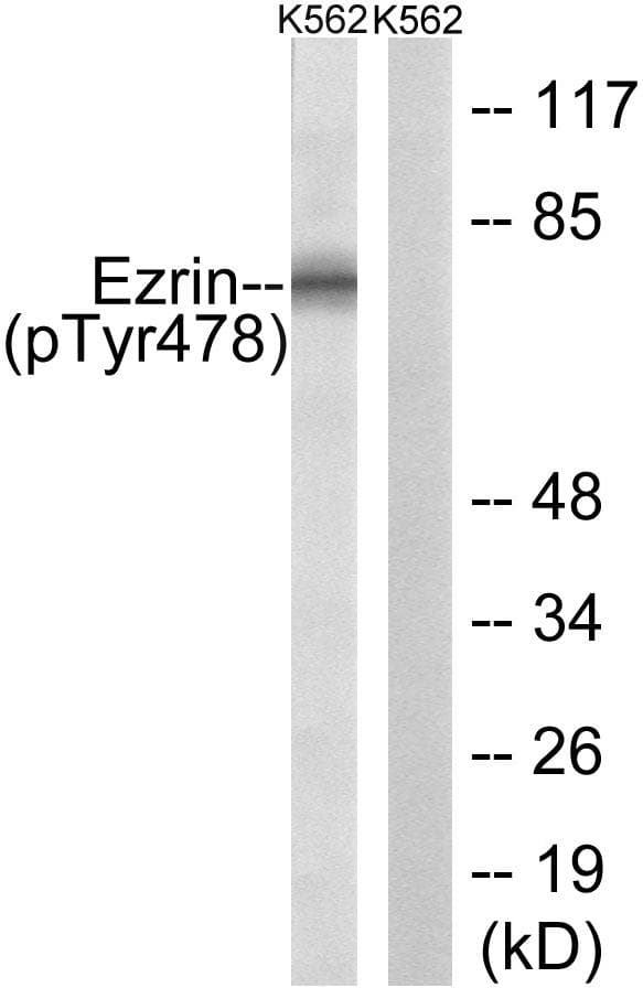 Polyclonal Rabbit anti-Human EZR / Ezrin Antibody (phospho-Tyr478, WB)
