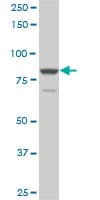 ERIC-1 / TACC3 Antibody (clone 6C4)