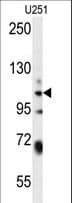 WWC3 Antibody (aa1008-1037)