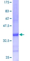 Human UBL5 Protein (Recombinant GST)