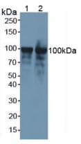 NCL / Nucleolin Antibody (aa353-568, PE)