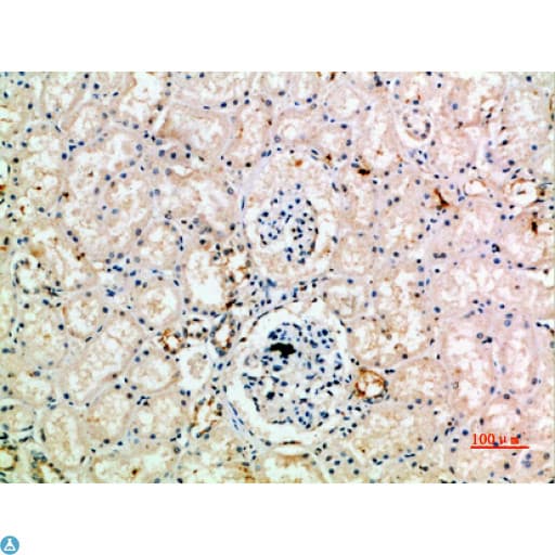 Polyclonal Rabbit anti-Human AcPL / IL18RAP Antibody (IHC)