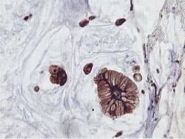 PFKP Antibody (clone OTI5F7)