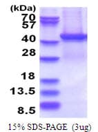 Human PSMD13 Protein (Recombinant His)